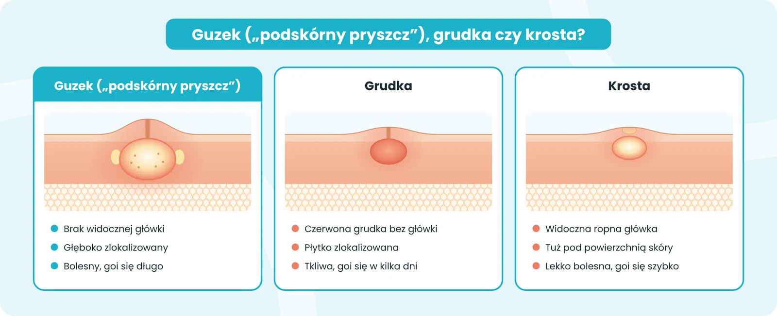 Porównanie guzka („podskórnego pryszcza”), grudki i krosty