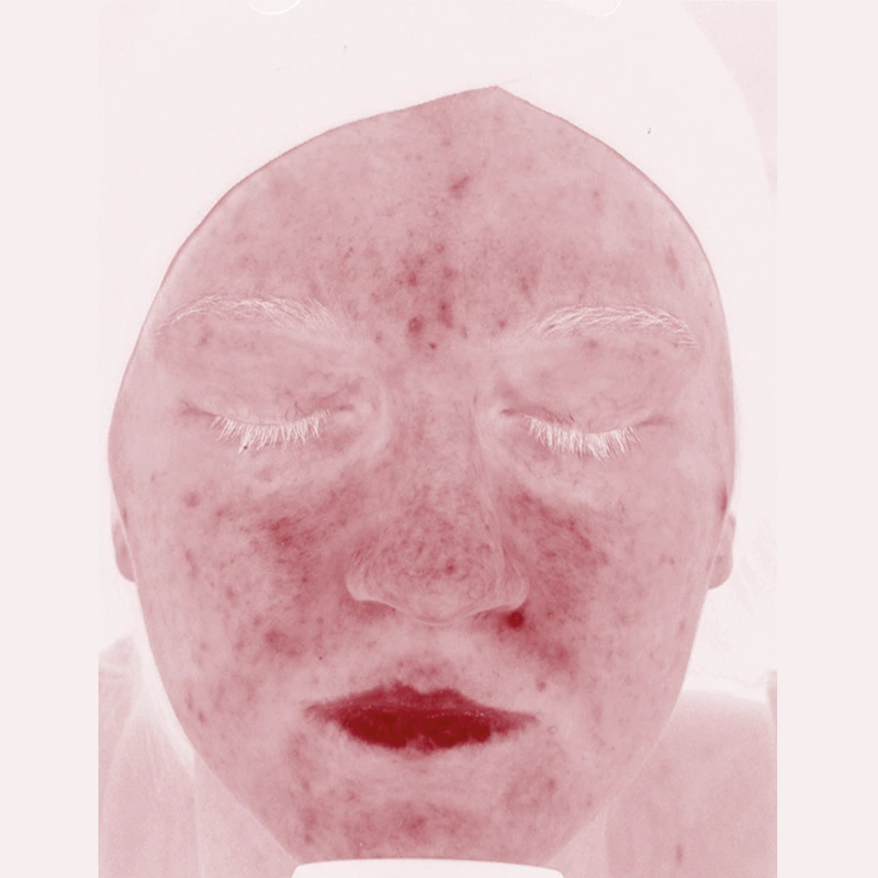 Po